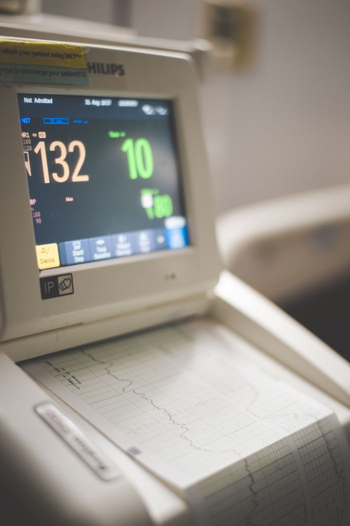 team-06 Close-up view of an ECG monitor displaying patient vitals and printed graphs.